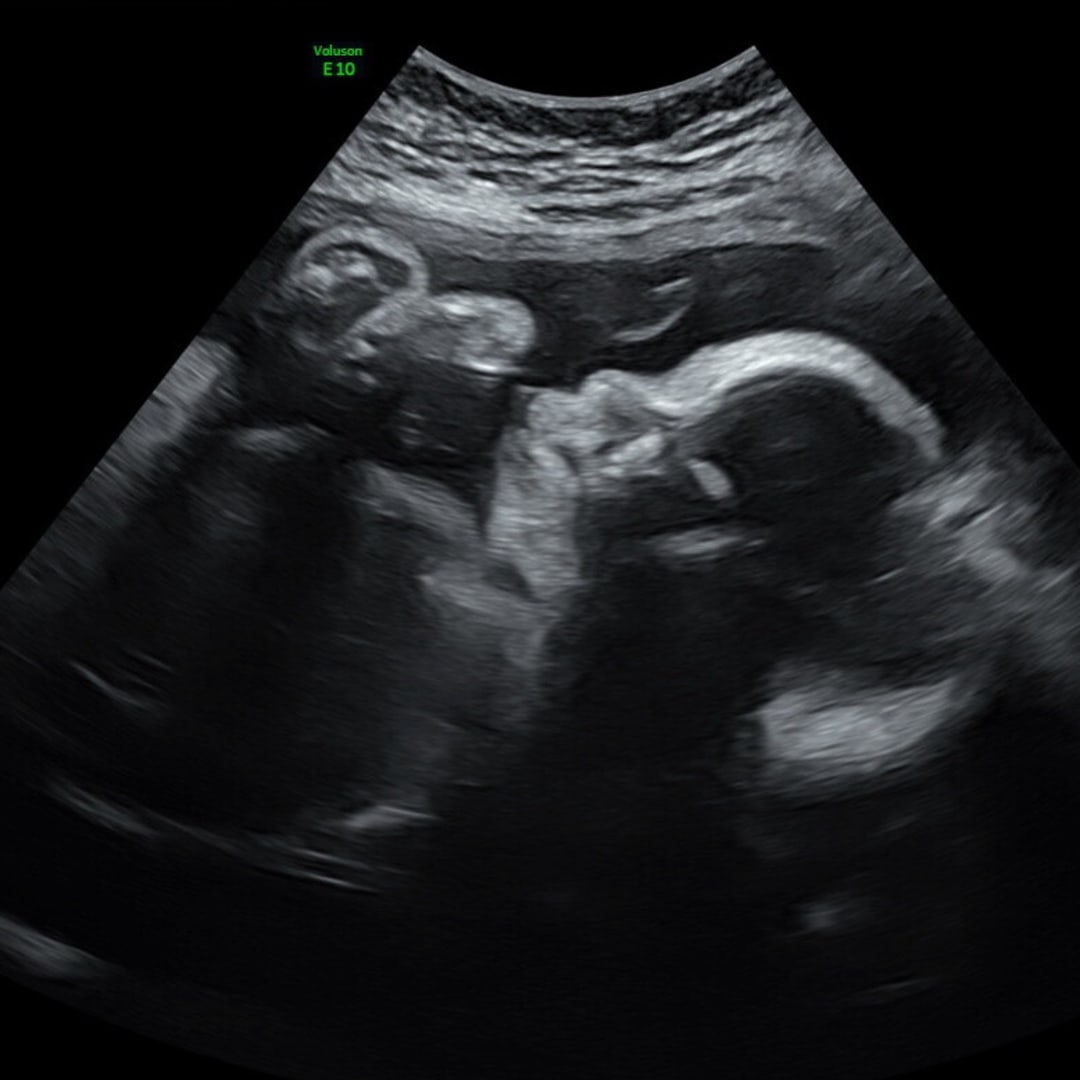 Photo shared by Gaby for their Babylist baby registry.