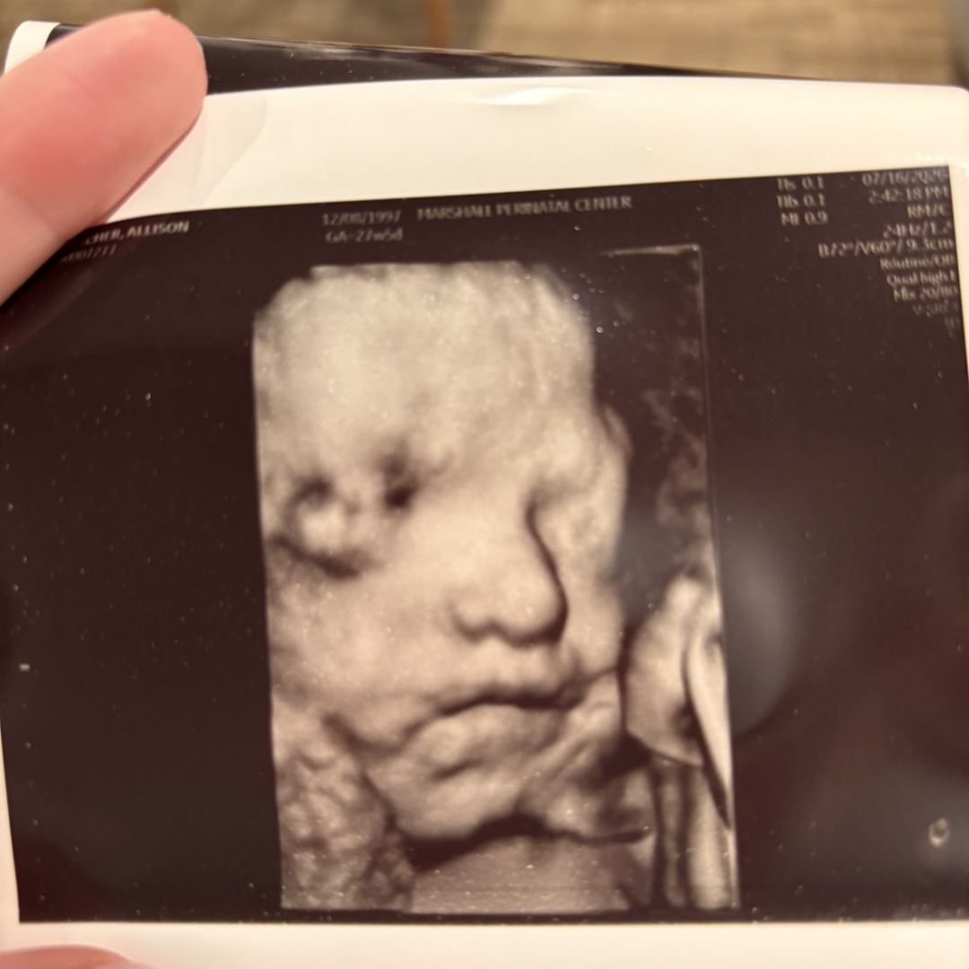 Photo shared by Allison for their Babylist baby registry.