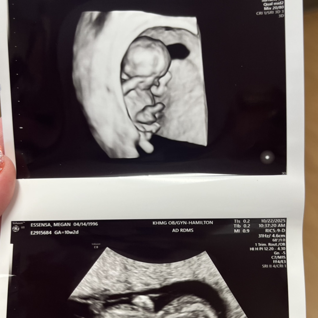 Photo shared by Megan for their Babylist baby registry.