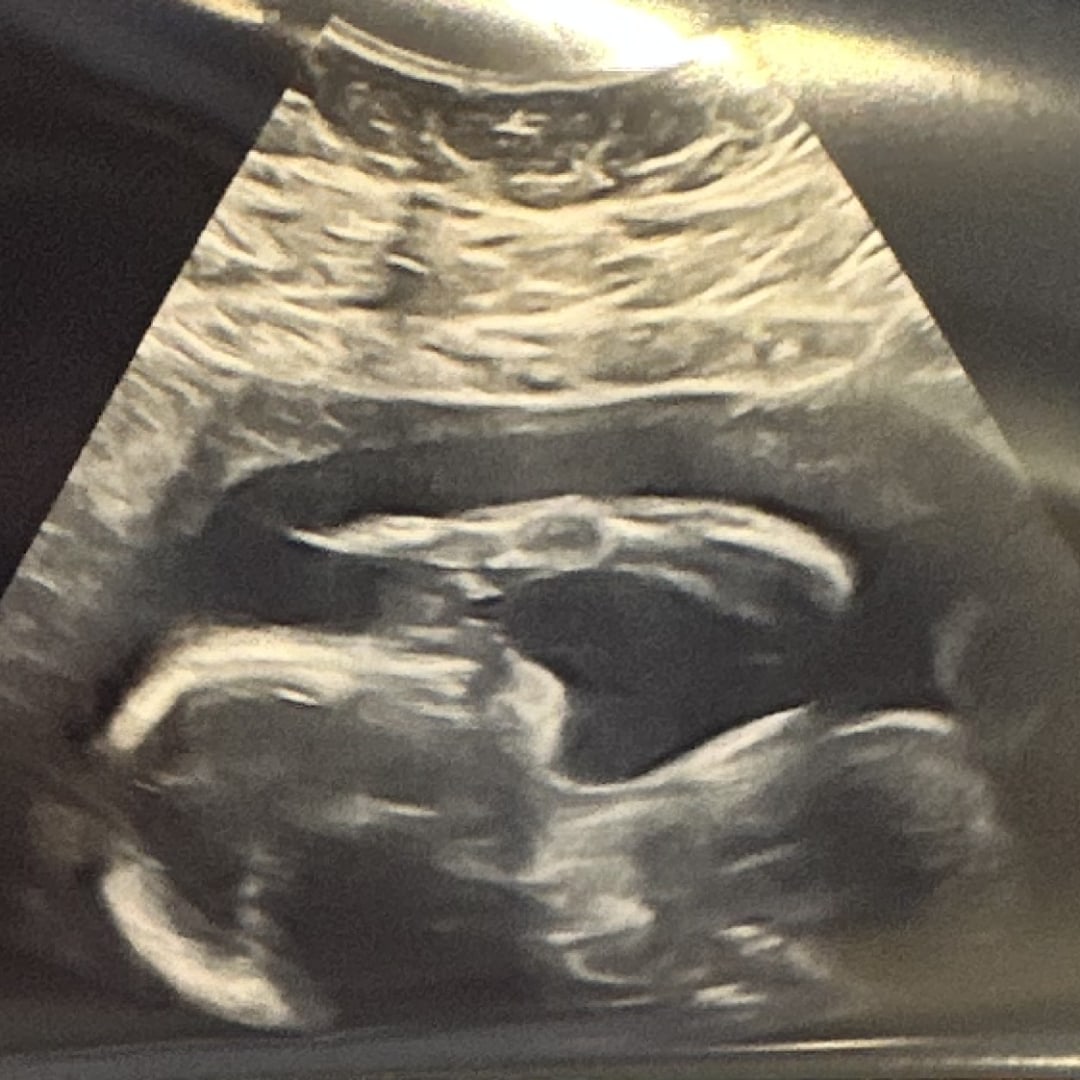 Photo shared by Kaleigh for their Babylist baby registry.