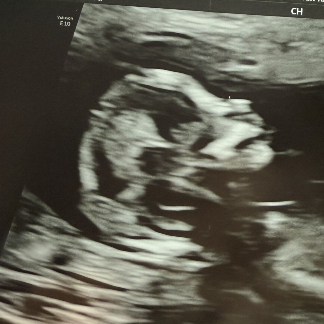 Photo shared by Alexandria for their Babylist baby registry.
