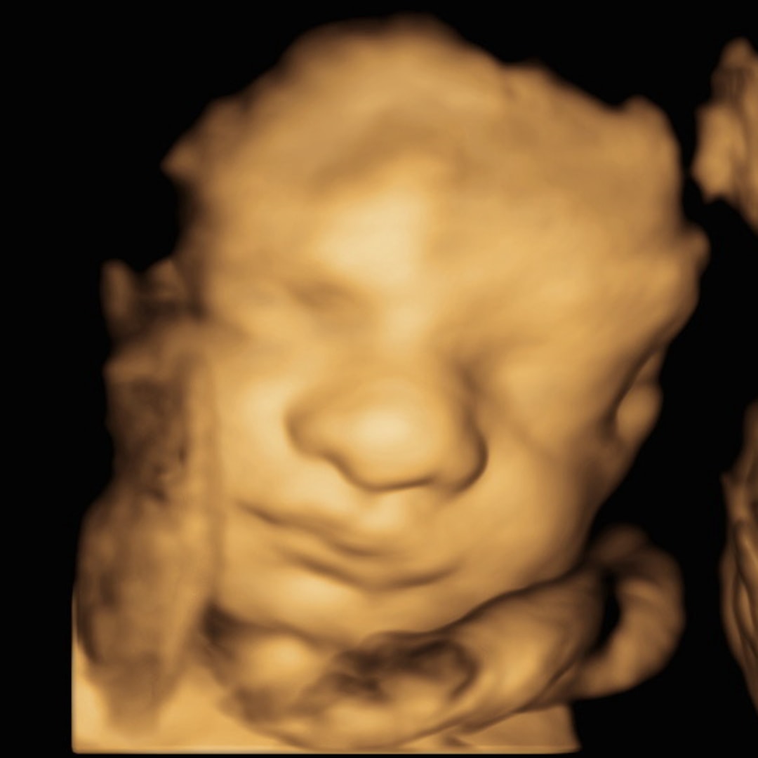 Photo shared by Nicole for their Babylist baby registry.