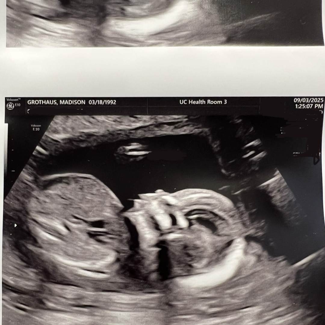 Photo shared by Madison for their Babylist baby registry.