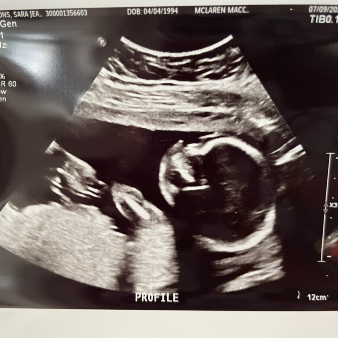 Photo shared by Sara for their Babylist baby registry.