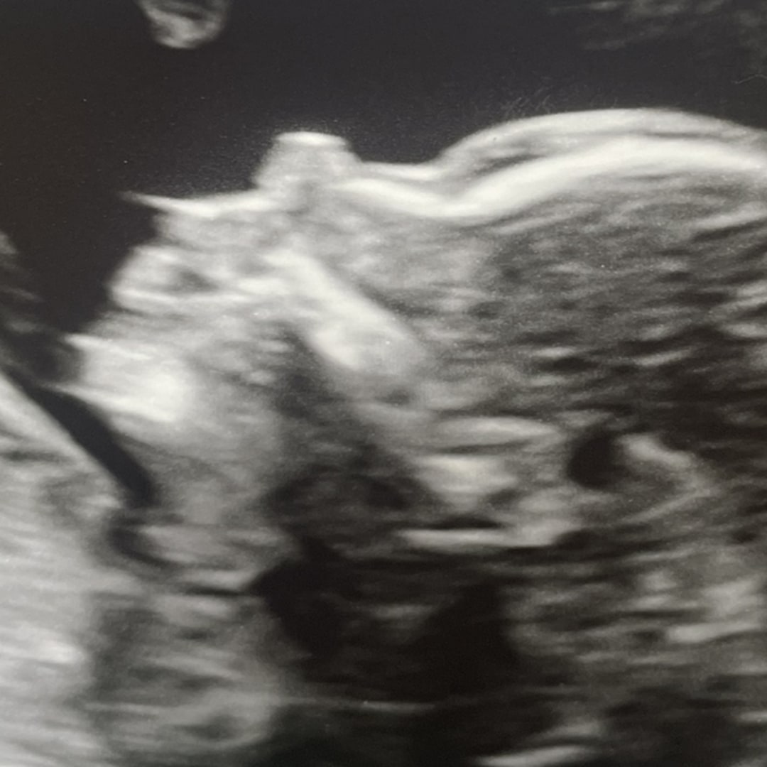 Photo shared by Kayla for their Babylist baby registry.