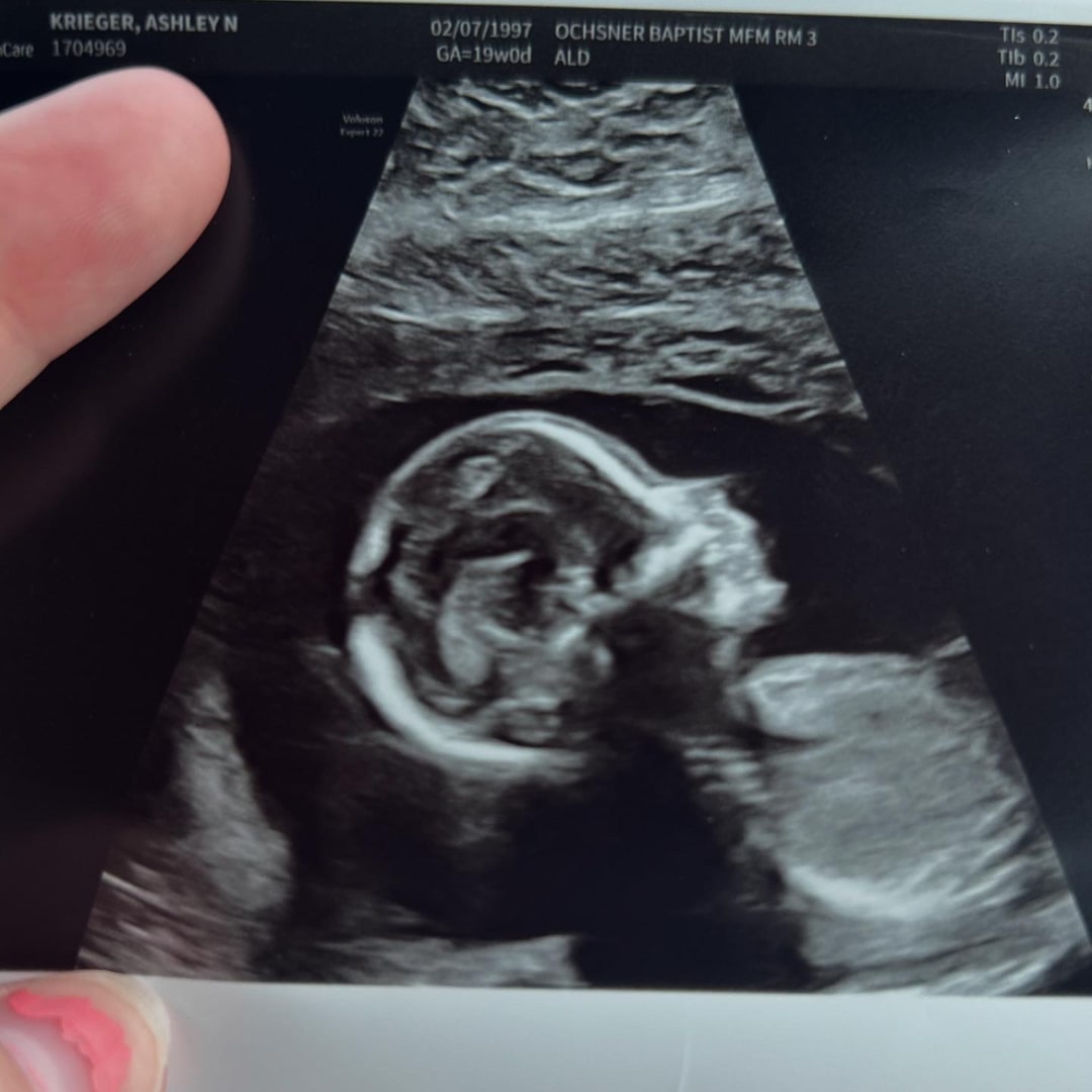 Photo shared by Ashley Nicole for their Babylist baby registry.