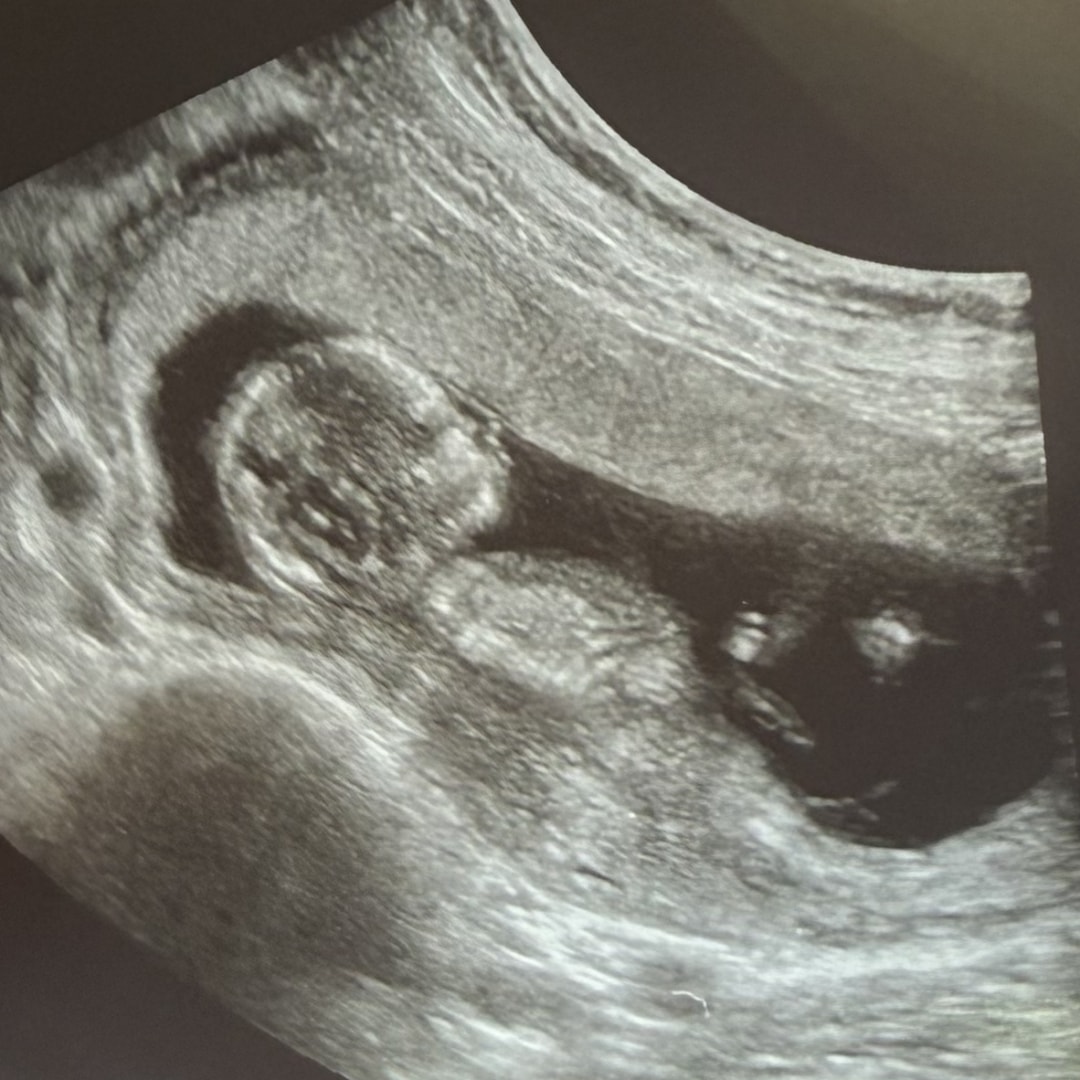 Photo shared by Jinny for their Babylist baby registry.
