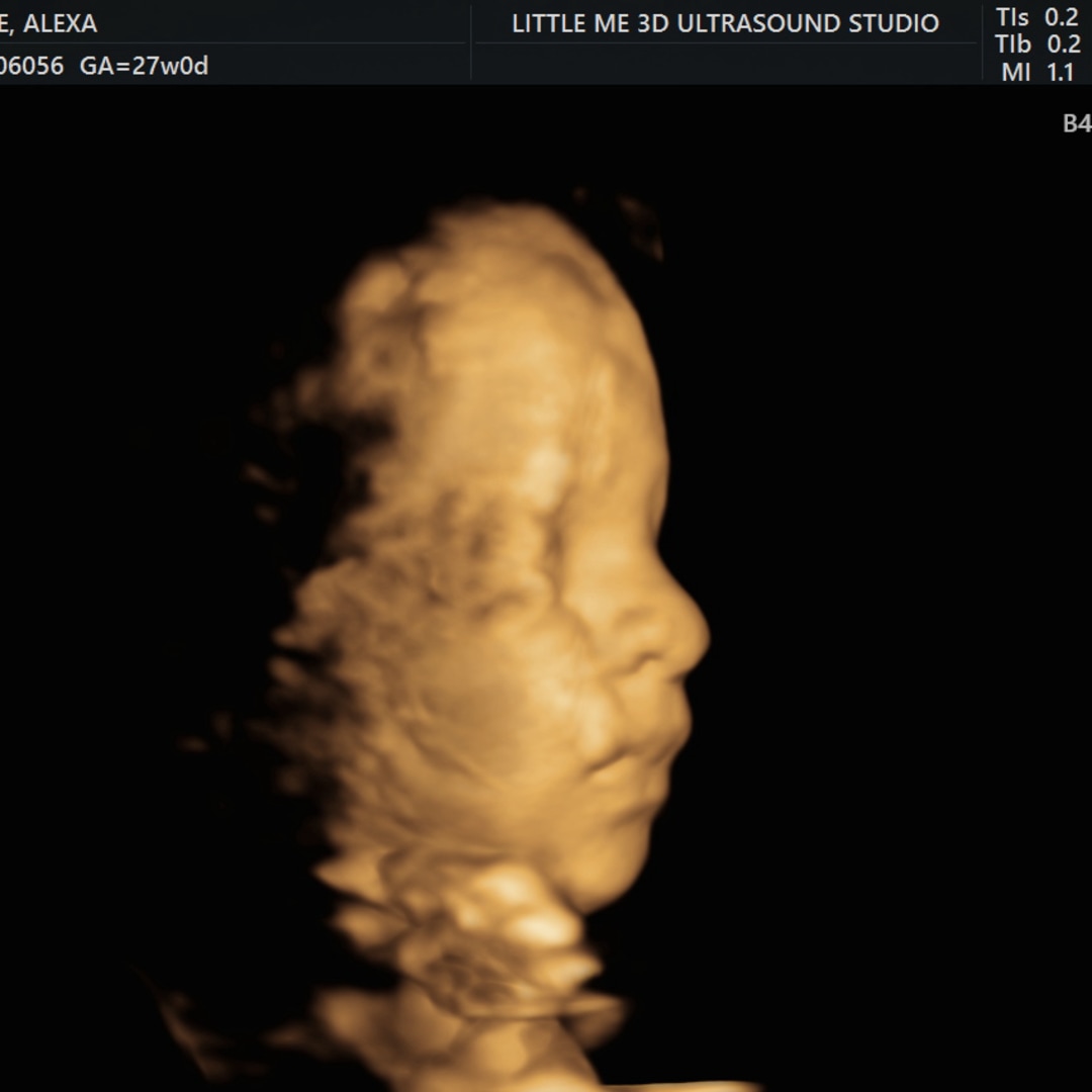 Photo shared by Alexa for their Babylist baby registry.