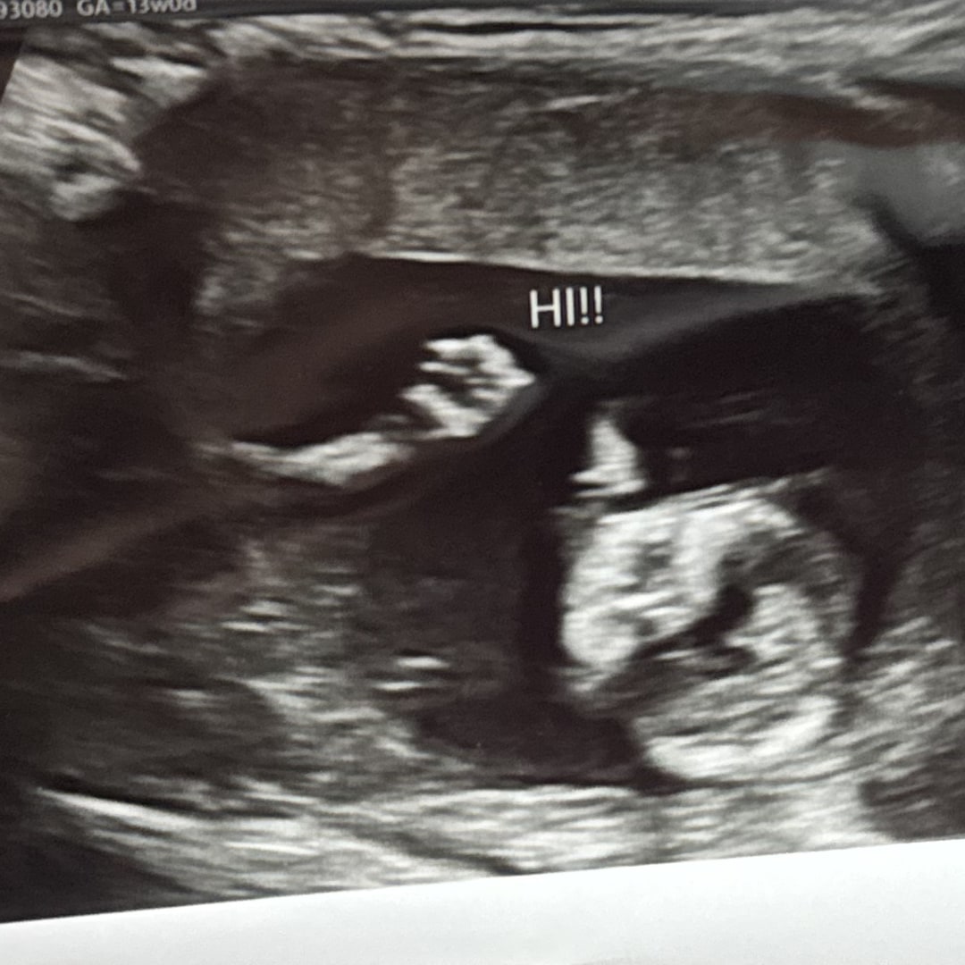Photo shared by Cynthia for their Babylist baby registry.