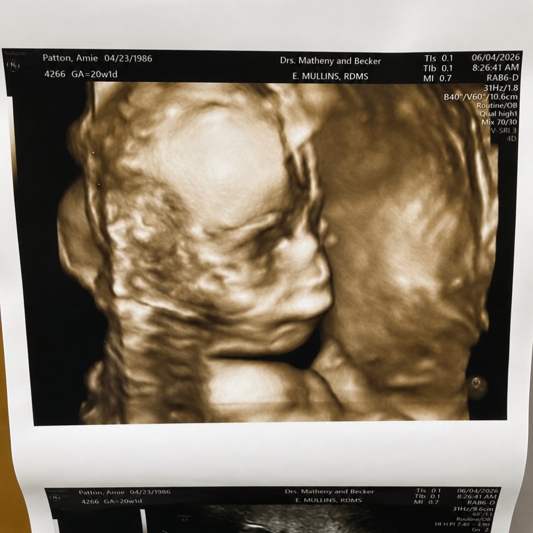 Photo shared by Nichole for their Babylist baby registry.