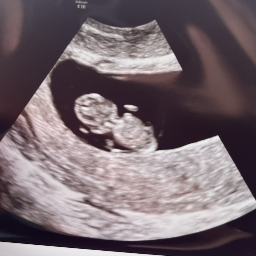 Photo shared by Anna for their Babylist baby registry.