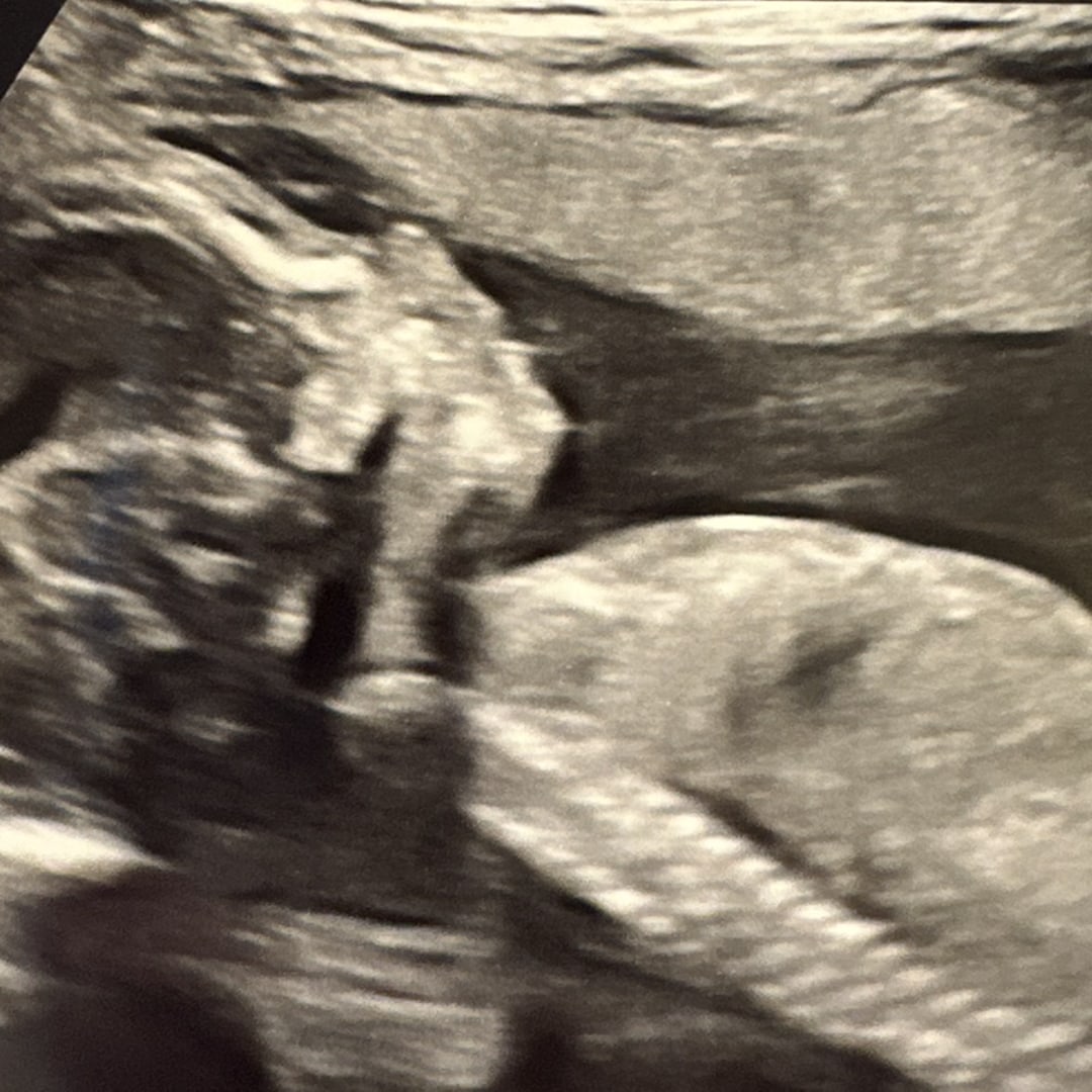 Photo shared by Lauren for their Babylist baby registry.