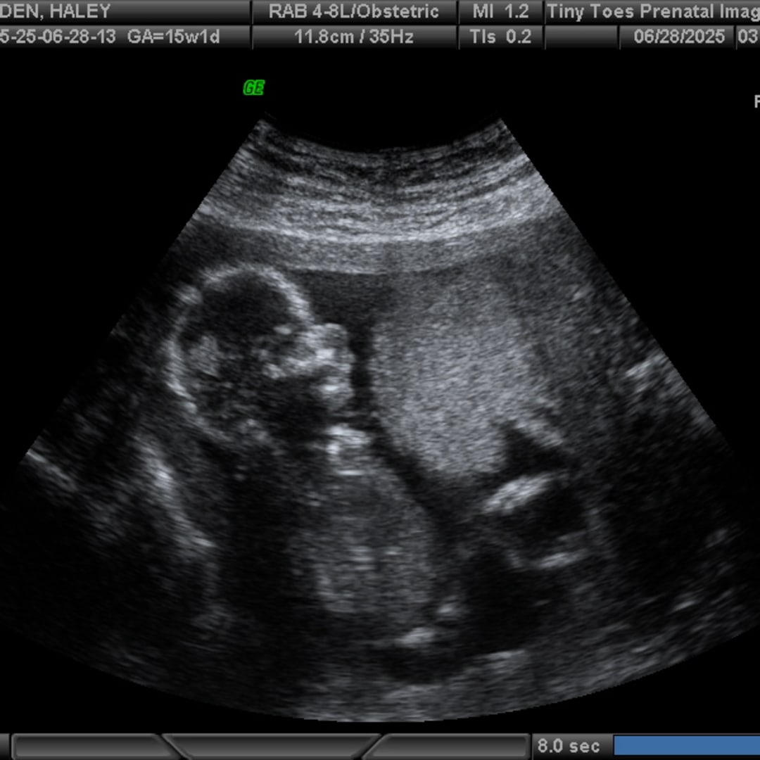 Photo shared by Haley for their Babylist baby registry.