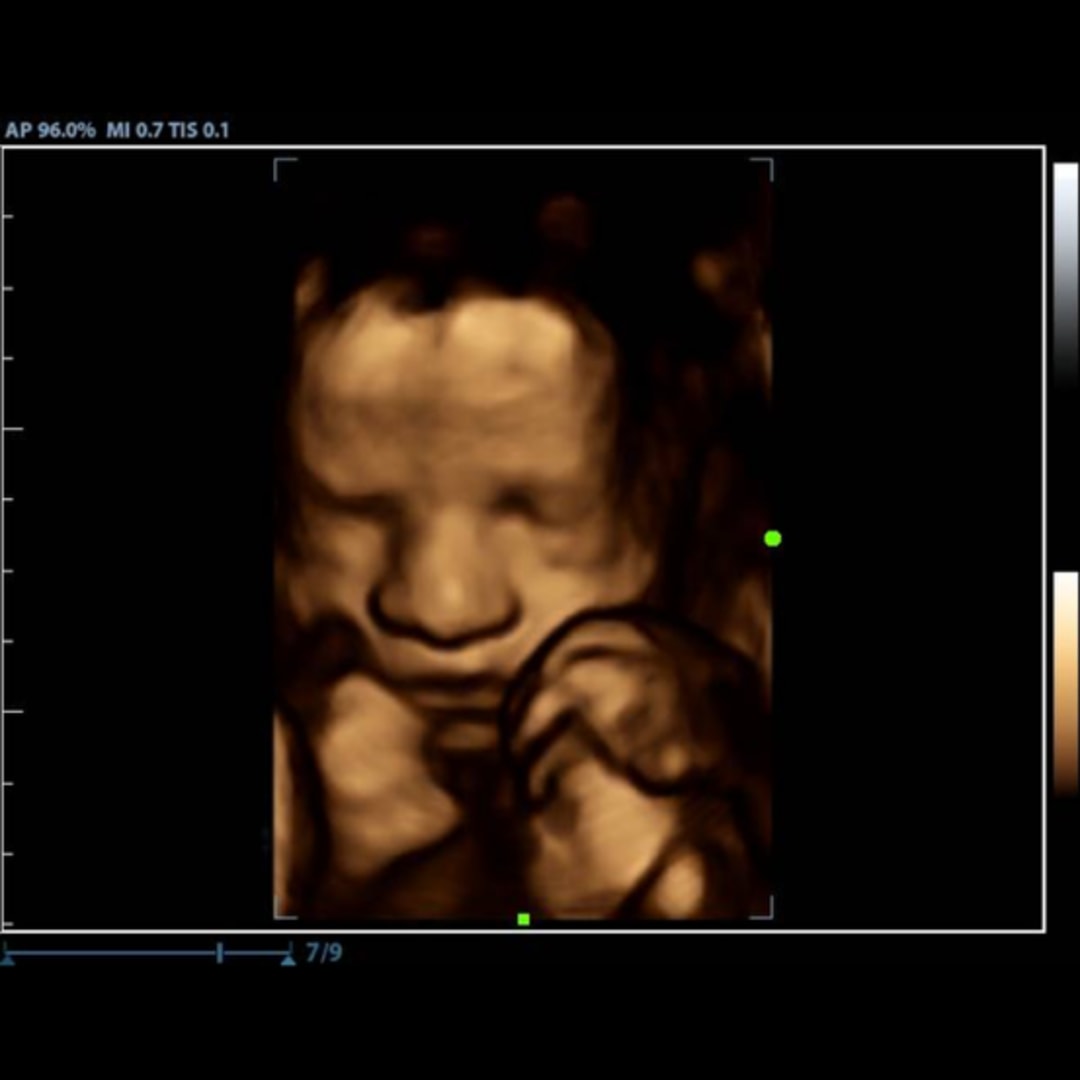 Photo shared by Chloe for their Babylist baby registry.