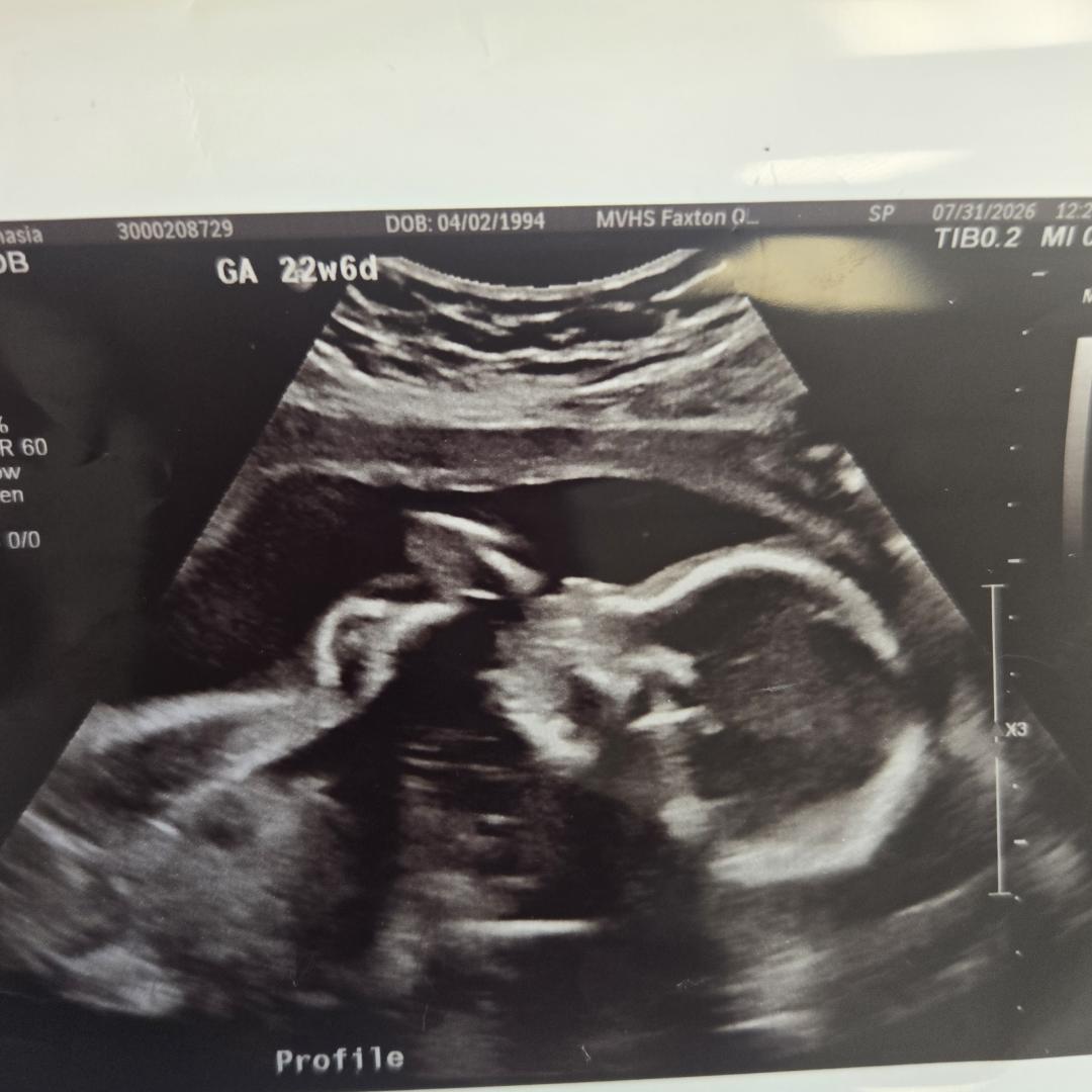 Photo shared by Deonasia for their Babylist baby registry.