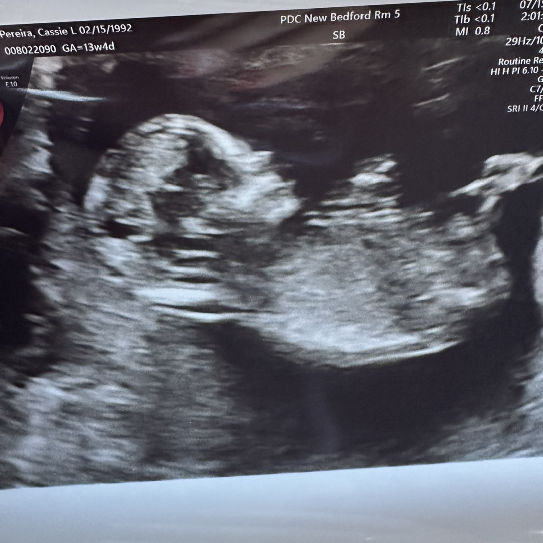 Photo shared by Cassie for their Babylist baby registry.