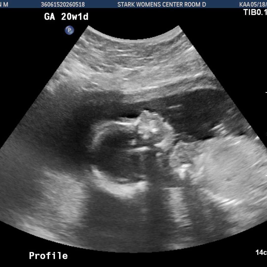 Photo shared by Brynlynn for their Babylist baby registry.