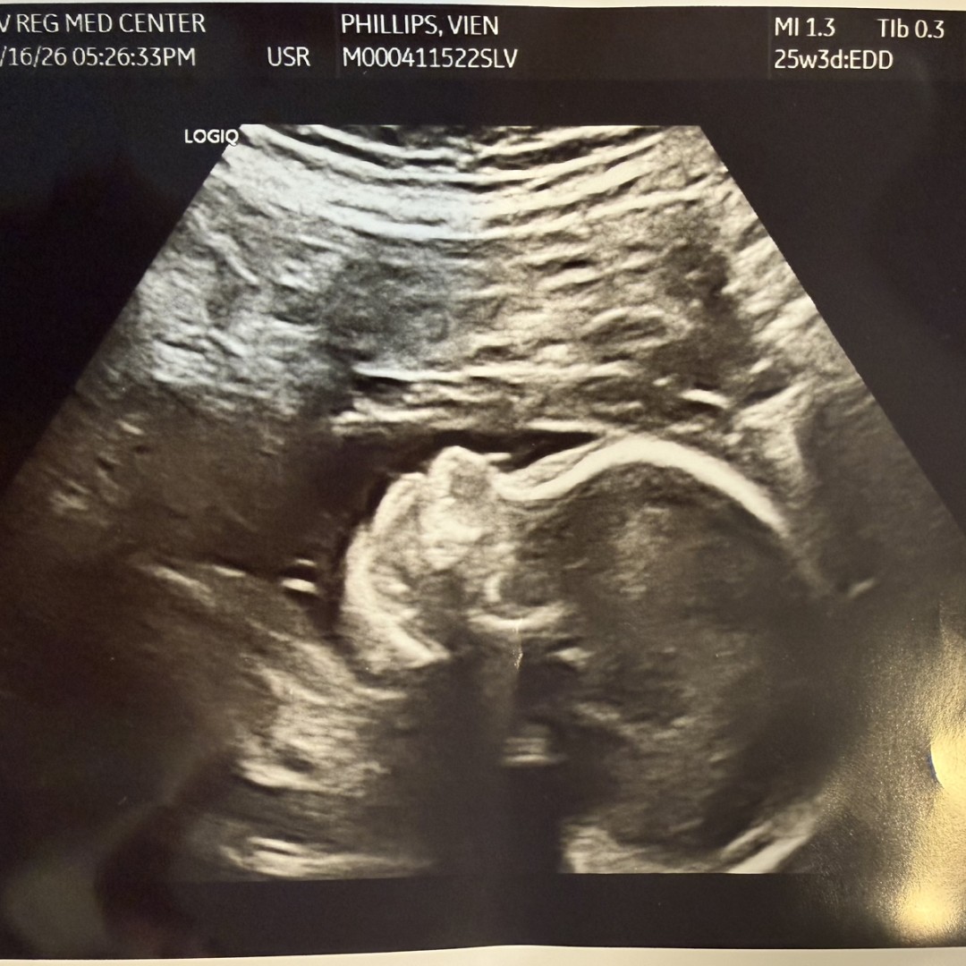 Photo shared by Athena for their Babylist baby registry.