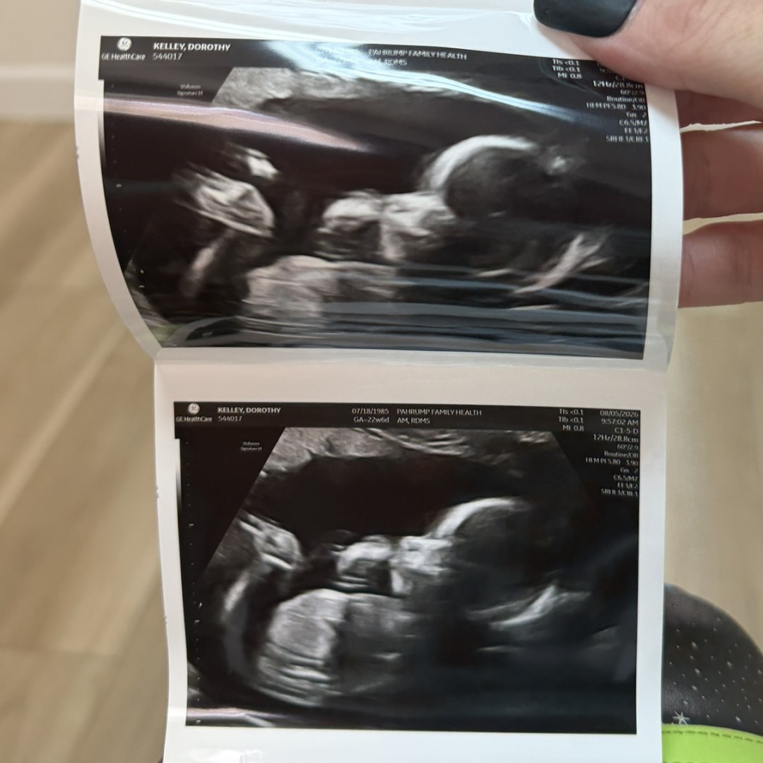 Photo shared by Dorothy for their Babylist baby registry.