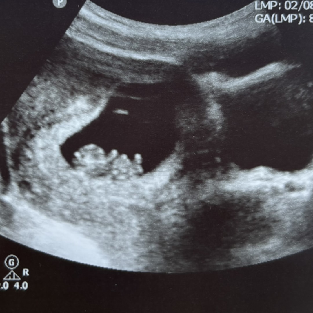 Photo shared by Carys for their Babylist baby registry.