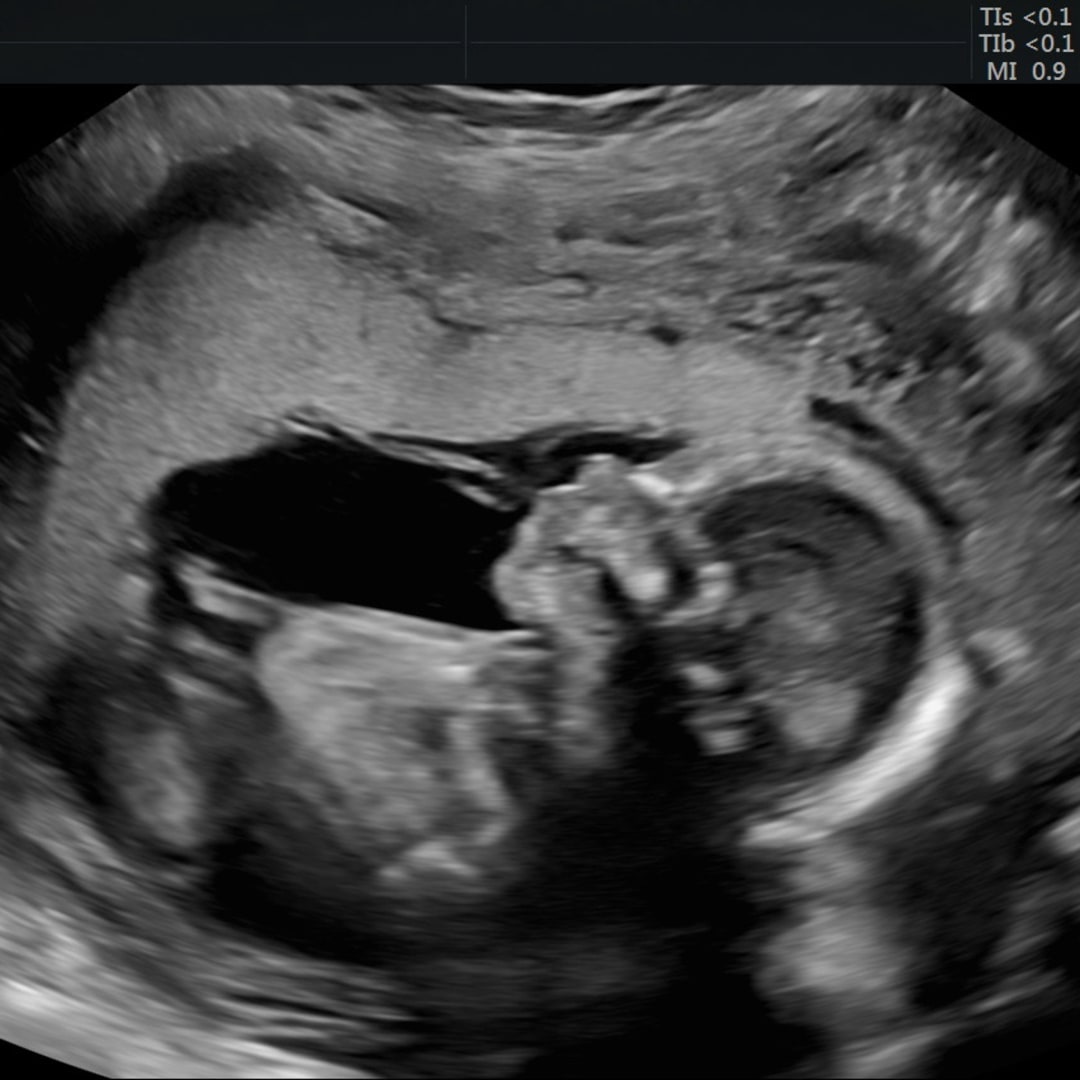 Photo shared by Eleni for their Babylist baby registry.