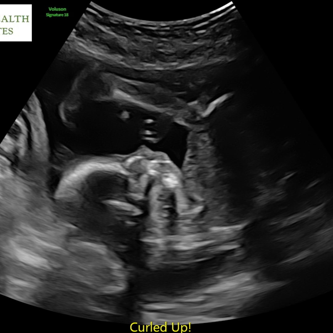 Photo shared by Jaida for their Babylist baby registry.