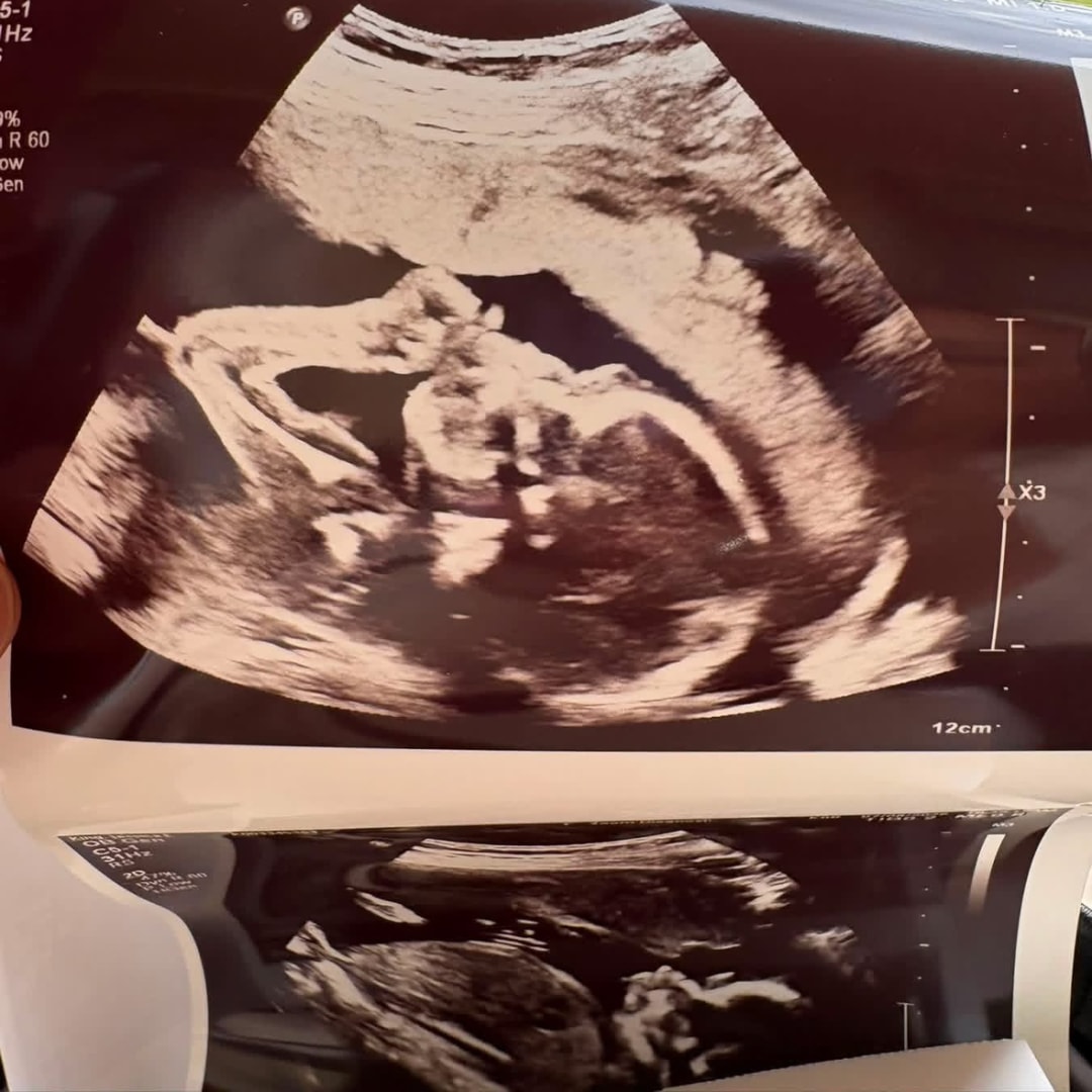 Photo shared by Ashley for their Babylist baby registry.