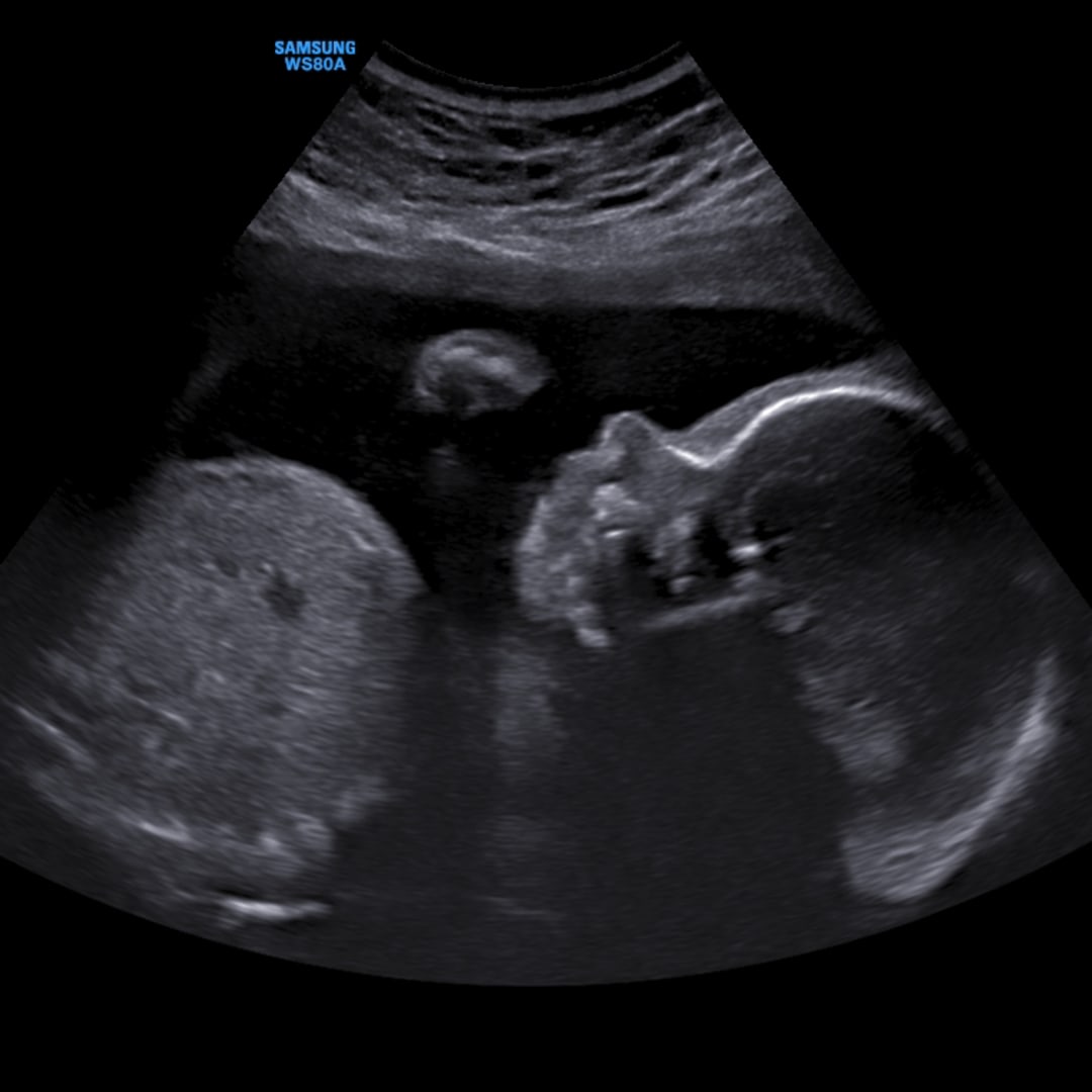 Photo shared by Allison for their Babylist baby registry.