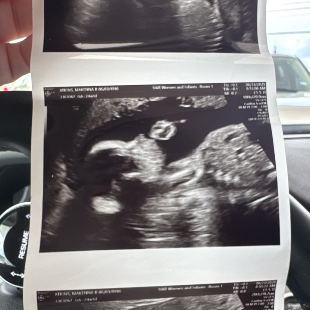 Photo shared by Kaitlyn for their Babylist baby registry.