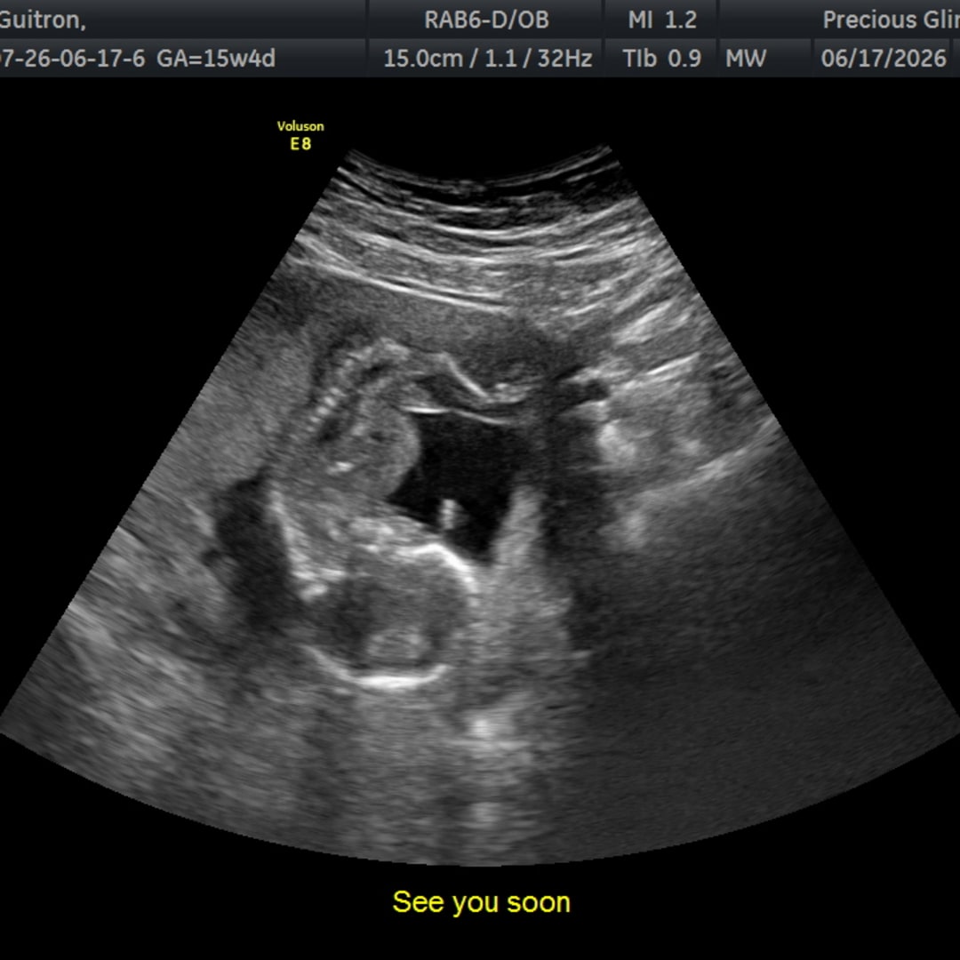 Photo shared by Sidney for their Babylist baby registry.