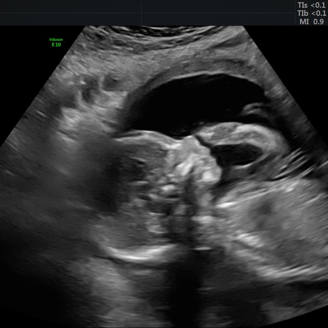 Photo shared by Alaina for their Babylist baby registry.