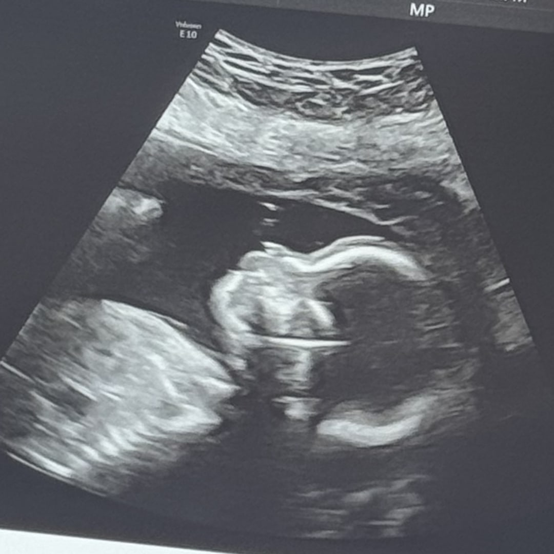 Photo shared by Aspen for their Babylist baby registry.