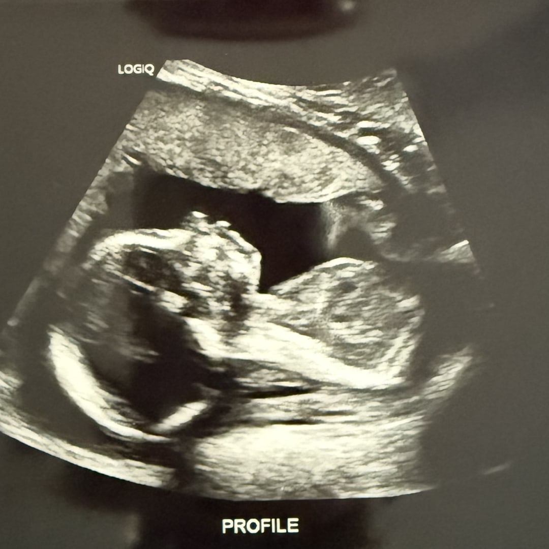 Photo shared by Kelsey for their Babylist baby registry.
