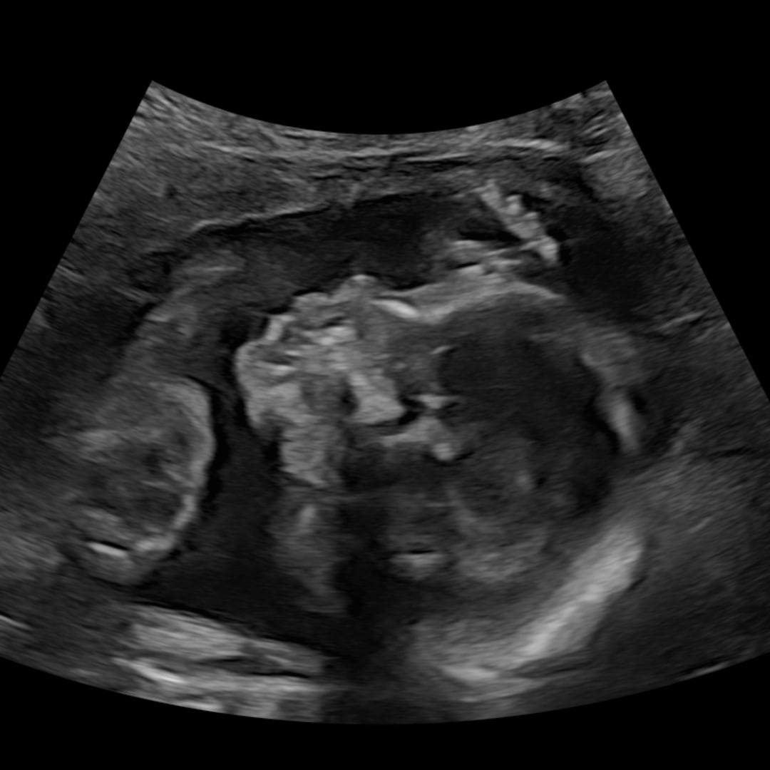 Photo shared by Christina for their Babylist baby registry.