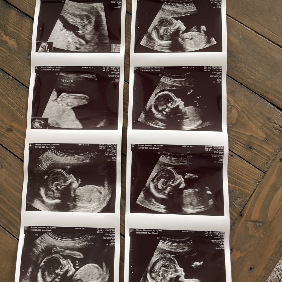 Photo shared by Madison for their Babylist baby registry.