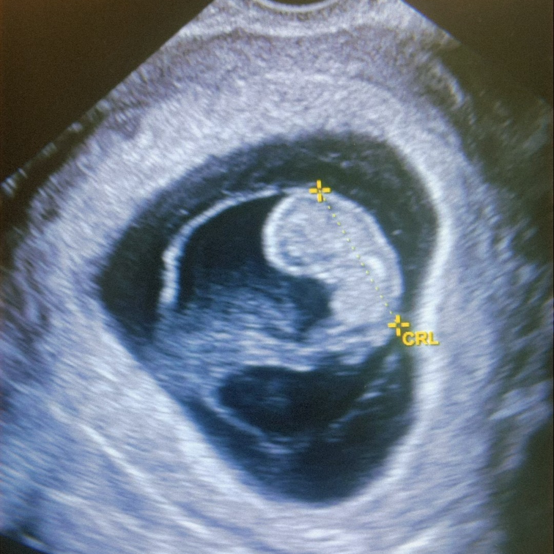 Photo shared by Aaryonna for their Babylist baby registry.