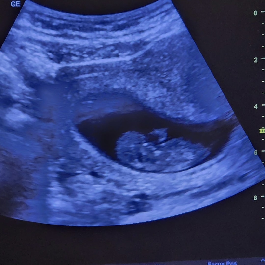 Photo shared by Ashley for their Babylist baby registry.