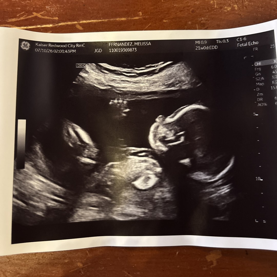 Photo shared by Melissa for their Babylist baby registry.