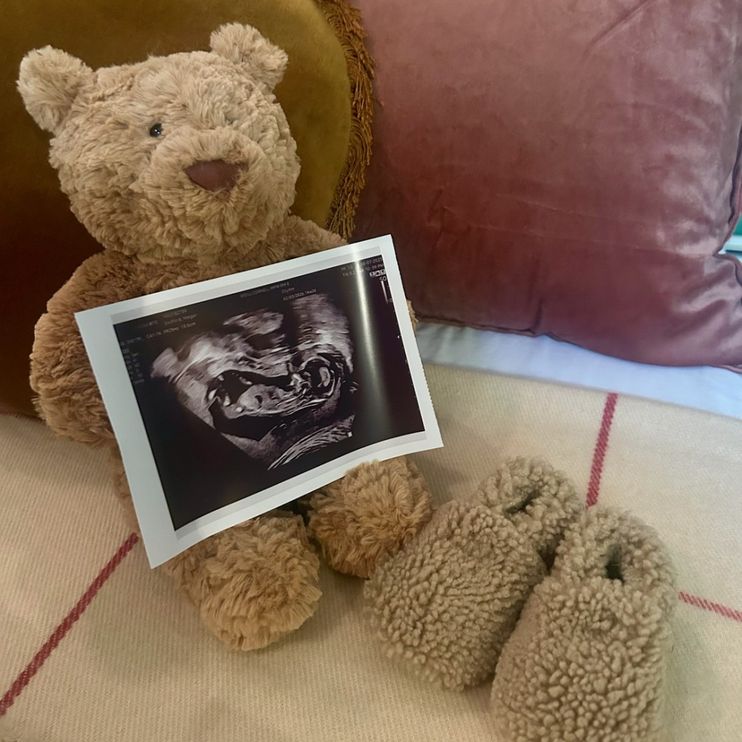 Photo shared by Megan for their Babylist baby registry.