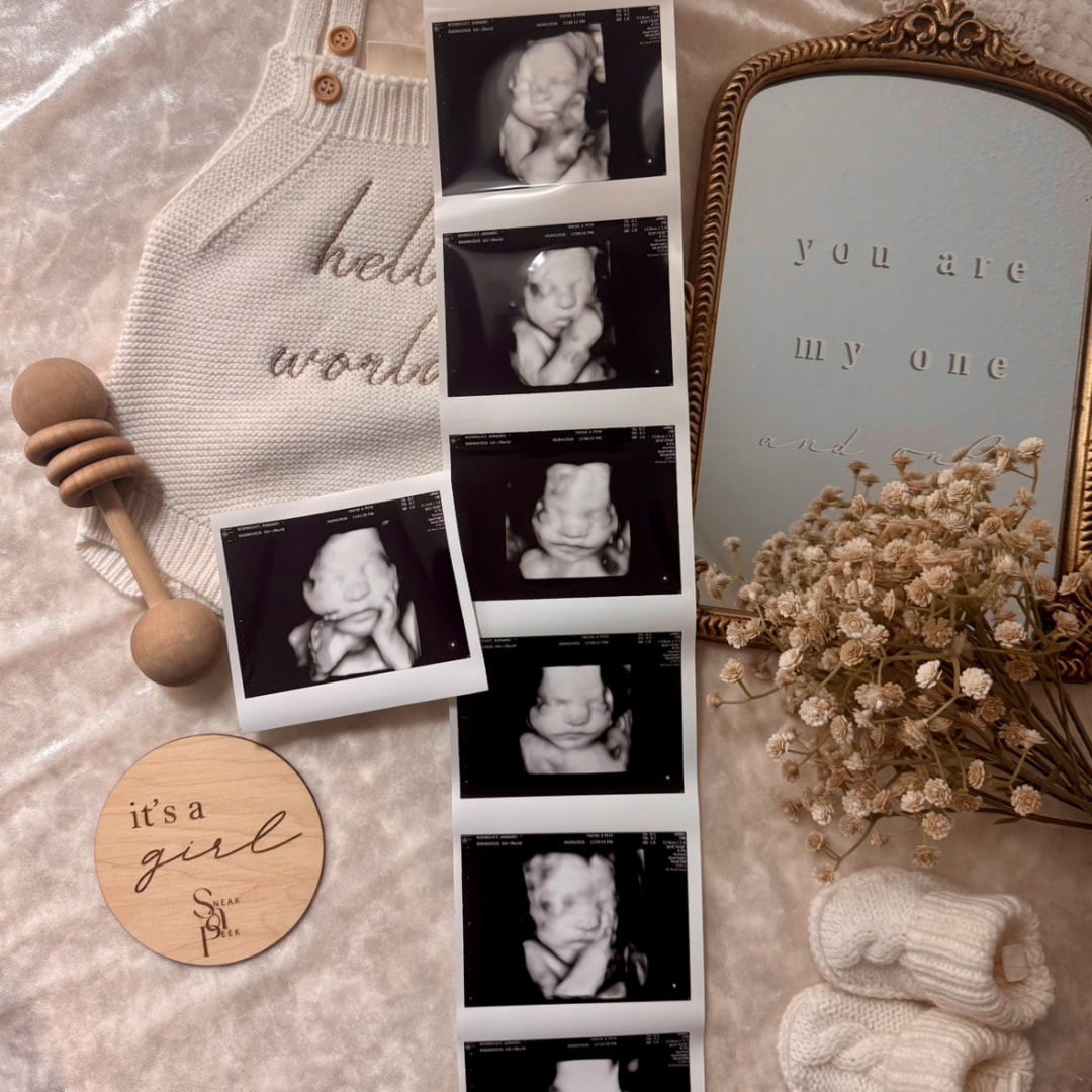 Photo shared by Annabel for their Babylist baby registry.