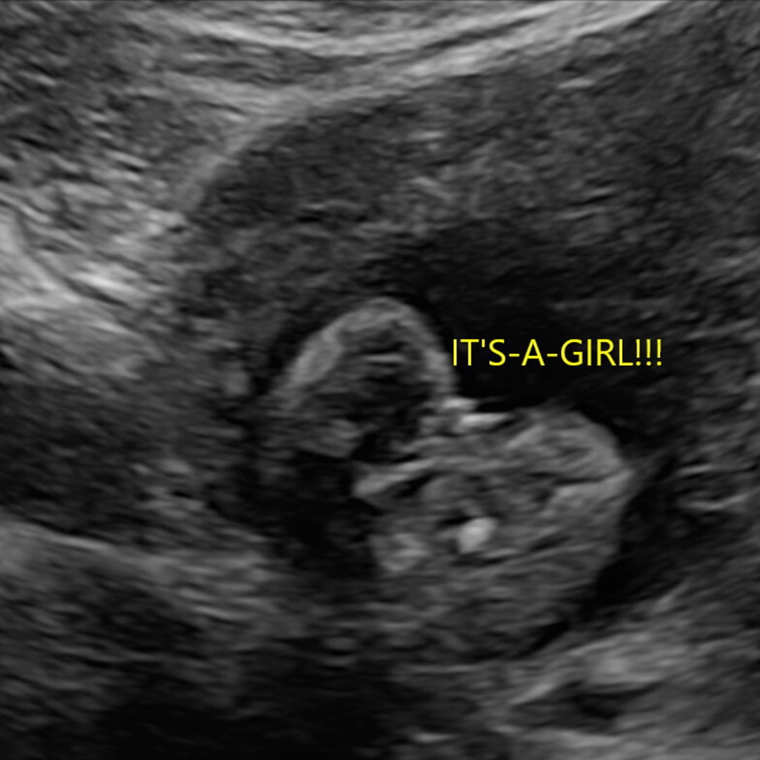 Photo shared by Abbey for their Babylist baby registry.