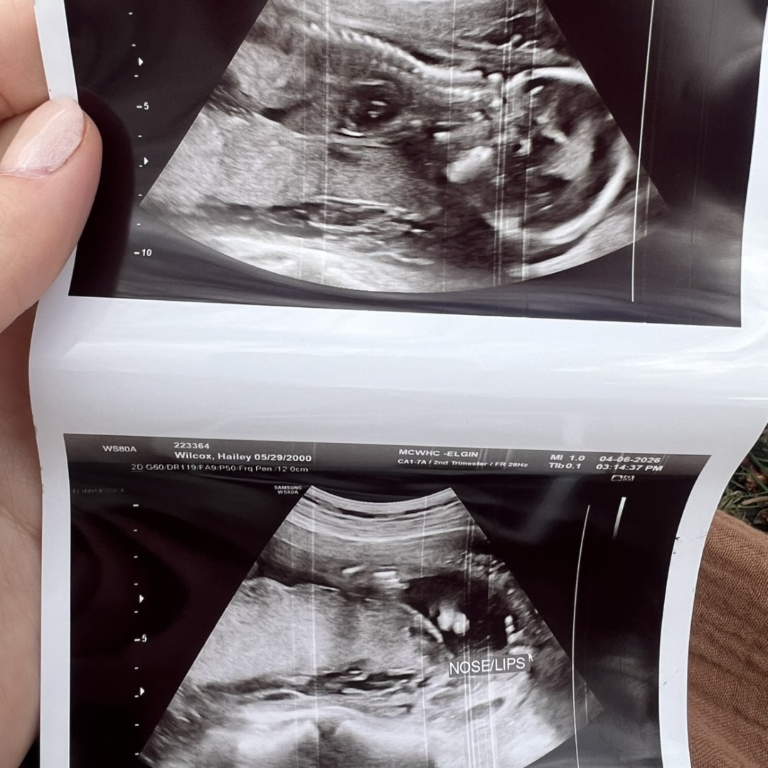 Photo shared by Hailey for their Babylist baby registry.