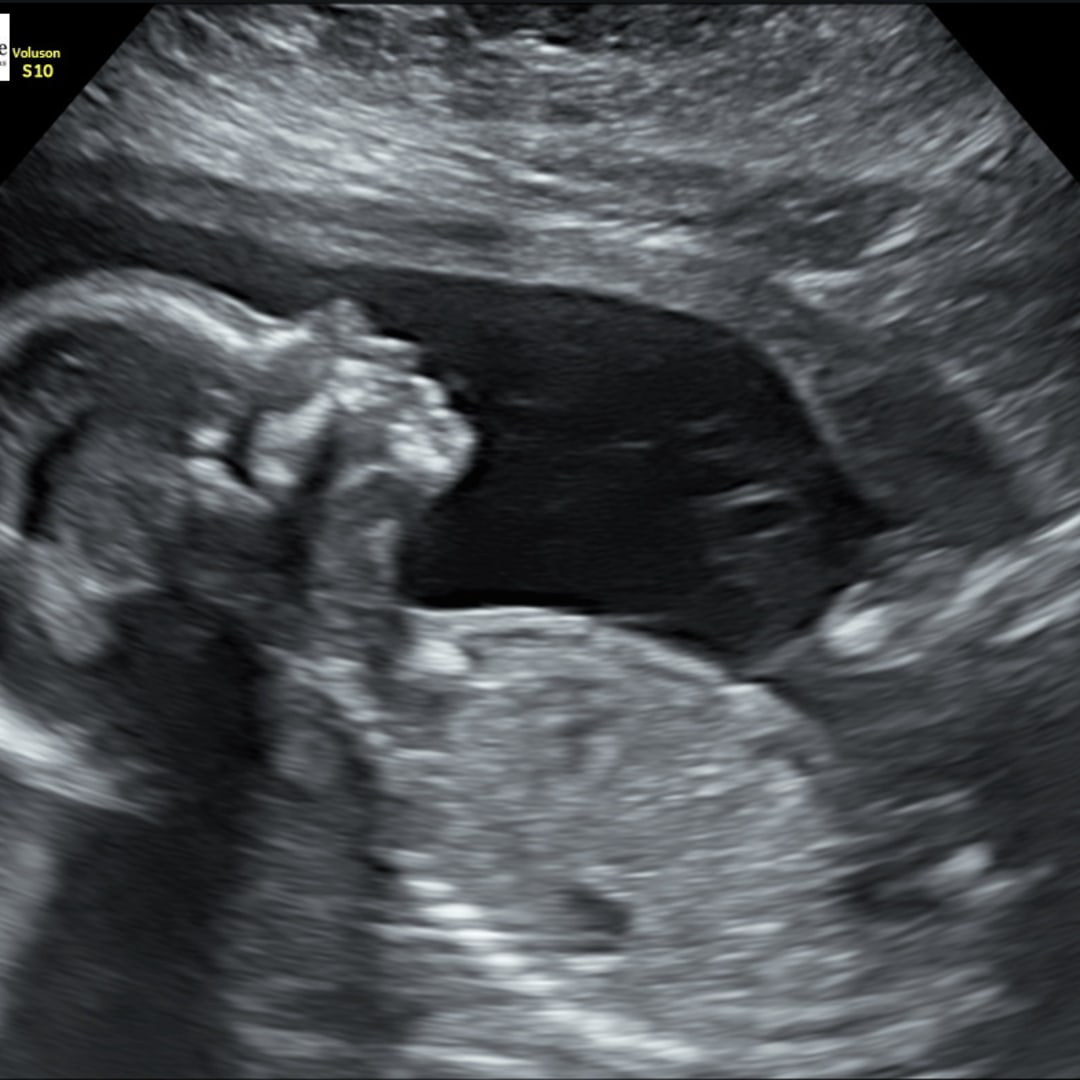 Photo shared by Belen for their Babylist baby registry.