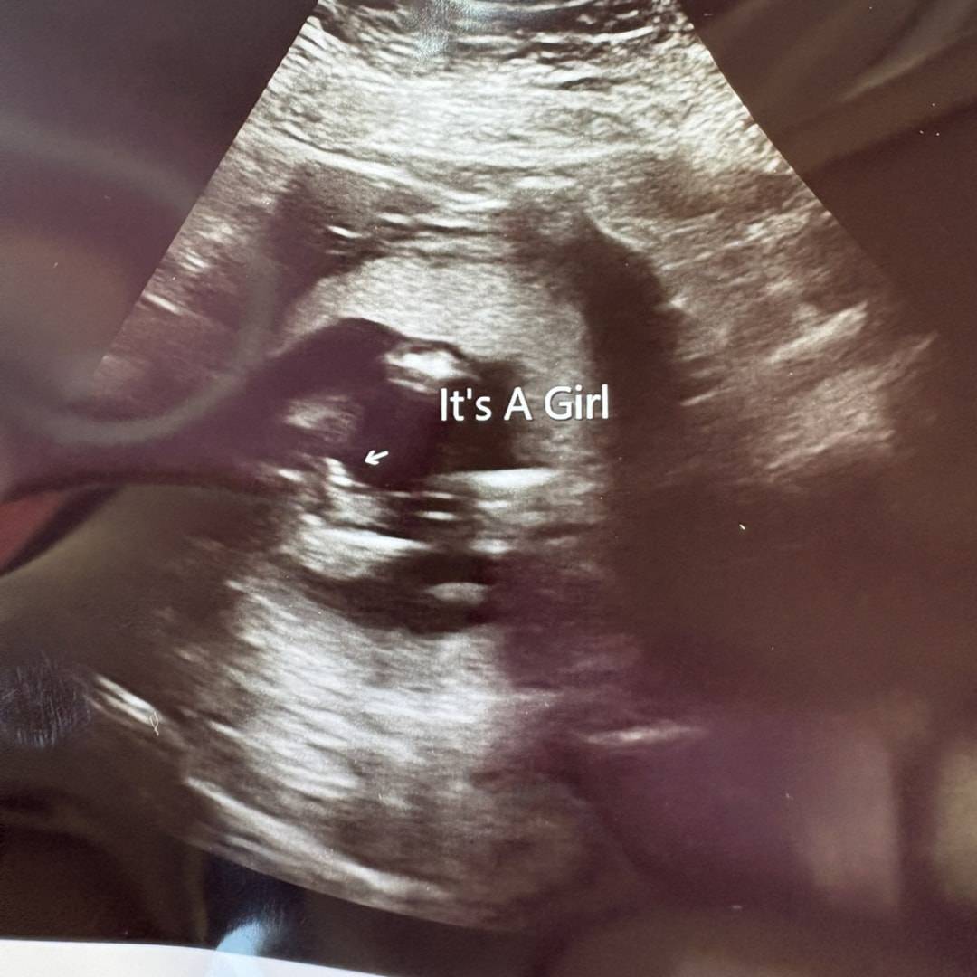 Photo shared by Marina for their Babylist baby registry.