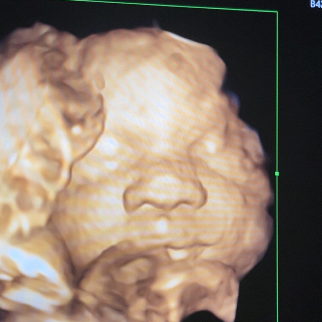 Photo shared by Hilary for their Babylist baby registry.