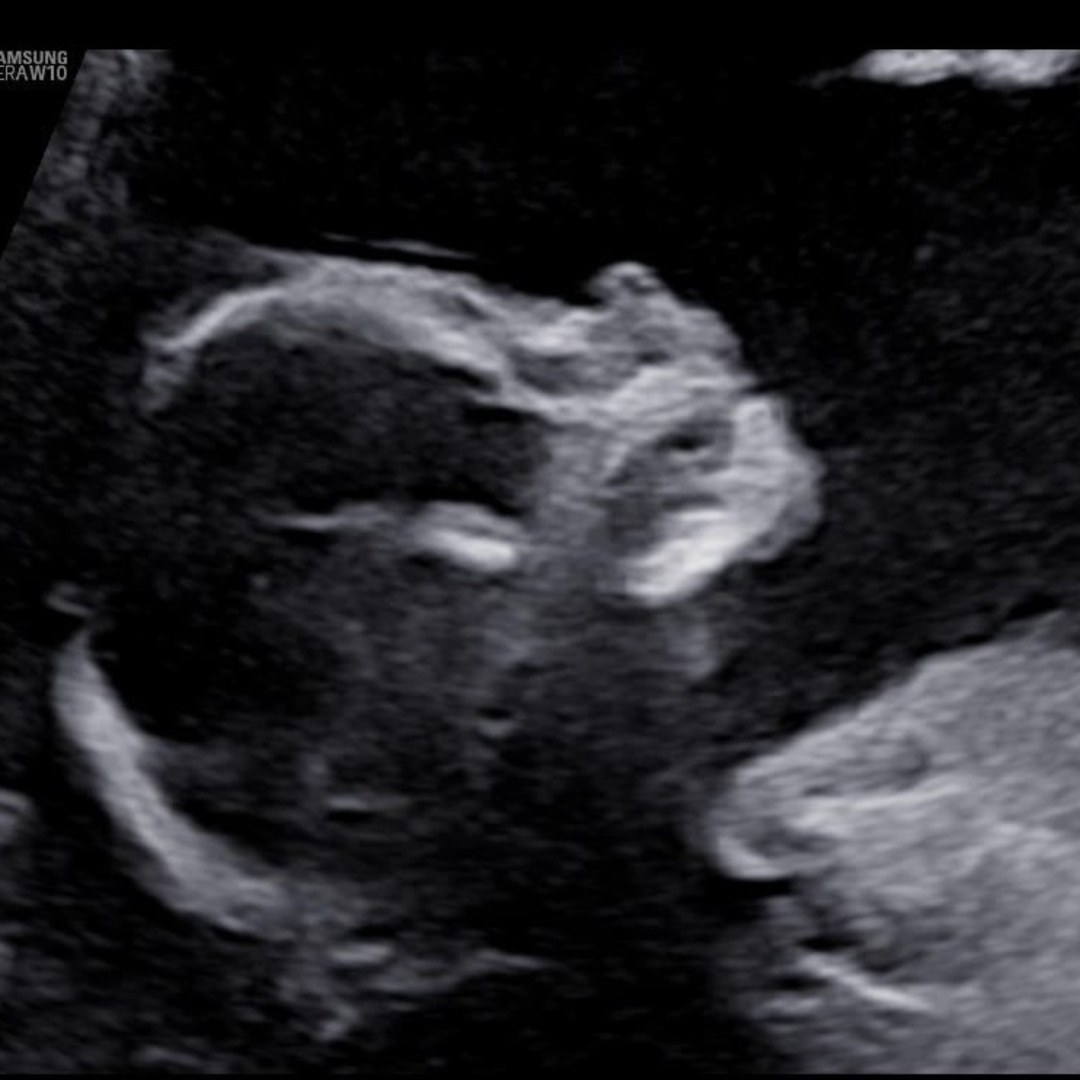 Photo shared by Tillandsia for their Babylist baby registry.