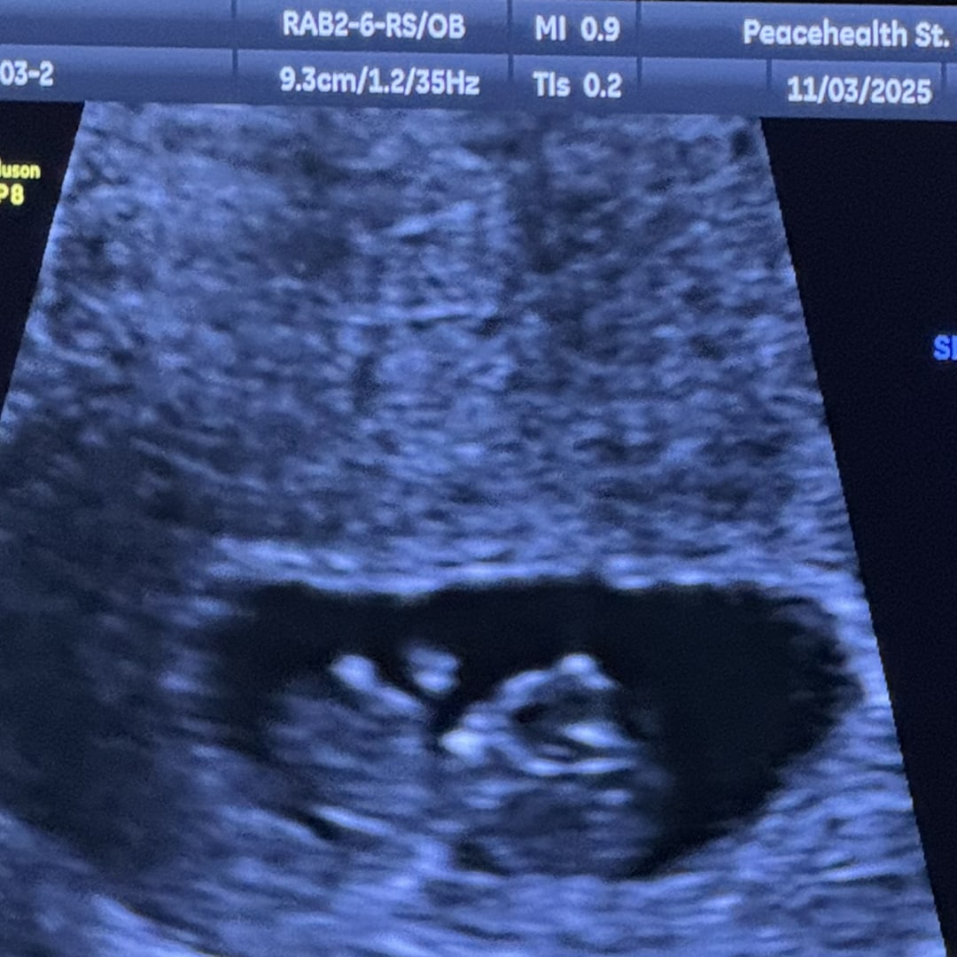 Photo shared by Jamie for their Babylist baby registry.