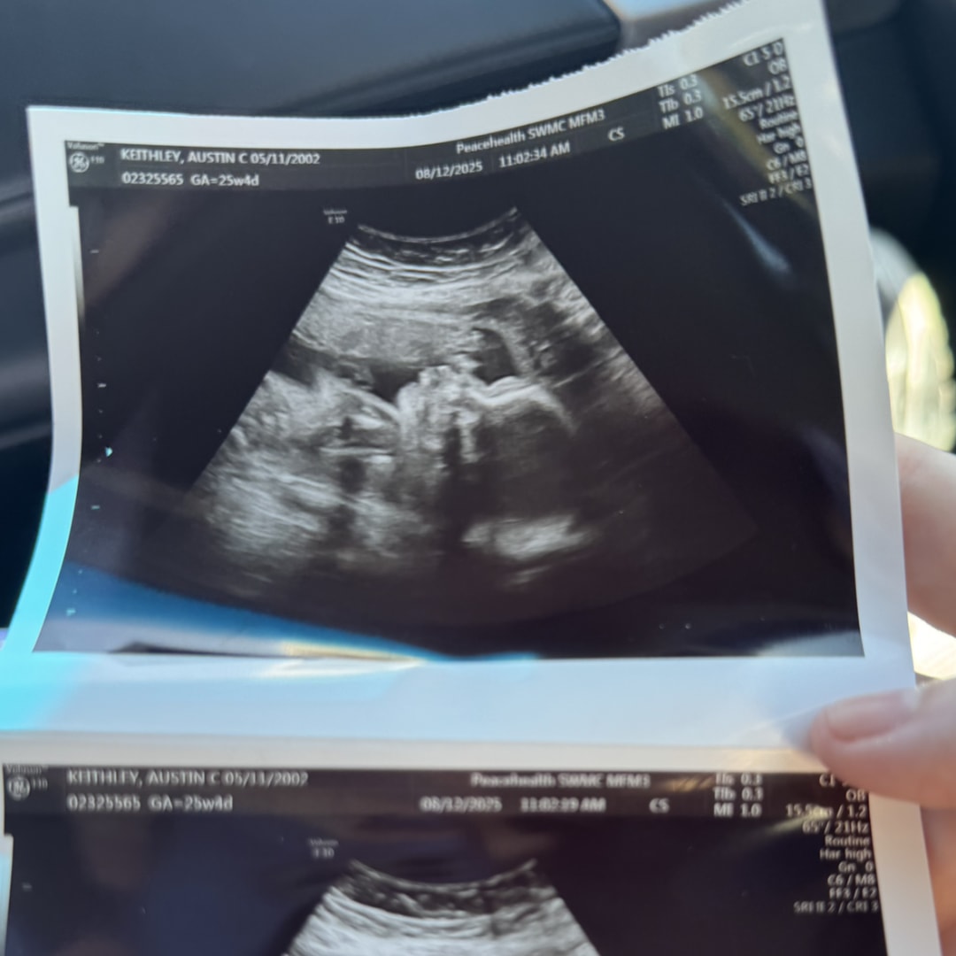 Photo shared by Austin for their Babylist baby registry.