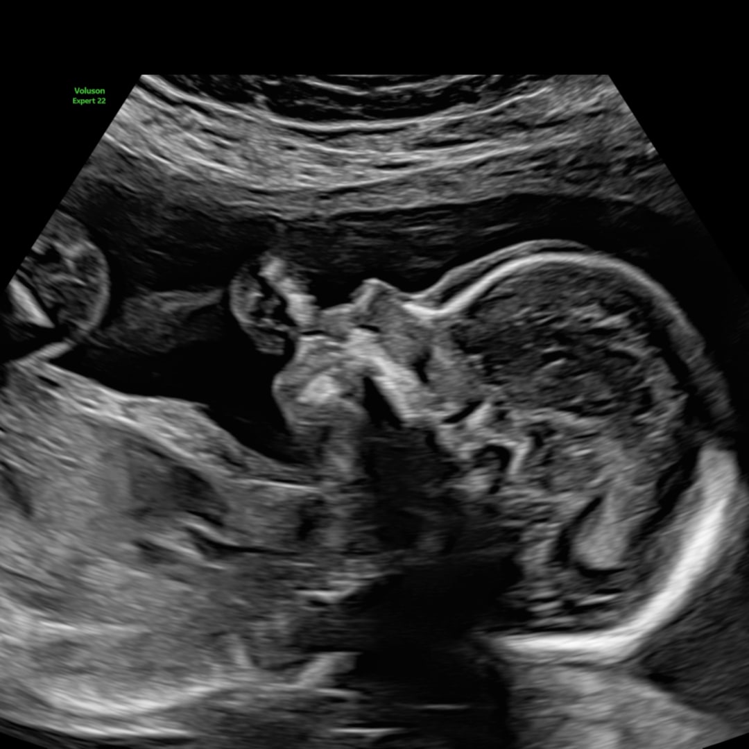 Photo shared by Daisy for their Babylist baby registry.