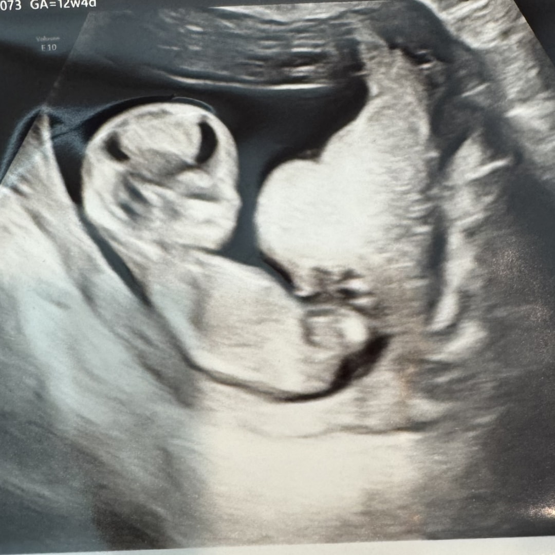 Photo shared by Robyn for their Babylist baby registry.
